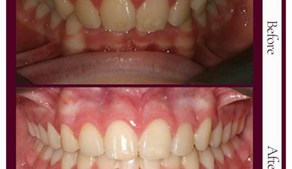 Capital Smiles Orthodontist - Deakin, ACT