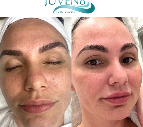 Juven8 Skin Oasis - Miami, FL