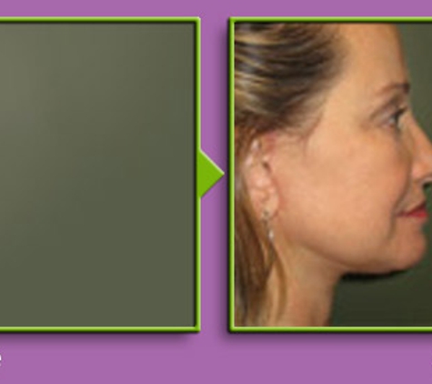 Graper Cosmetic Surgery - Charlotte, NC