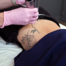 LaserAway Boulder - Hair Removal