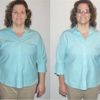 True Weightloss Solutions gallery