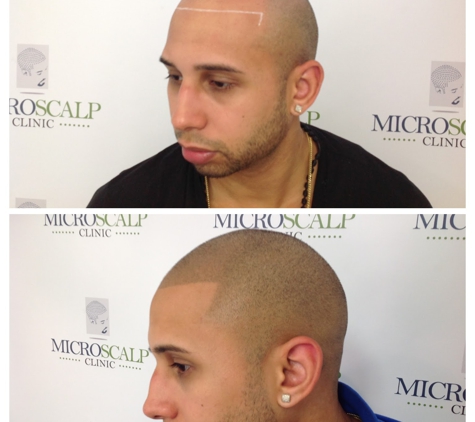 MicroScalp Clinic - Fairhaven, MA