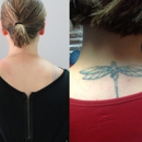 Tataway - Tattoo Removal