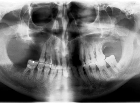 Spring Orchid Dental - Bassendean, WA