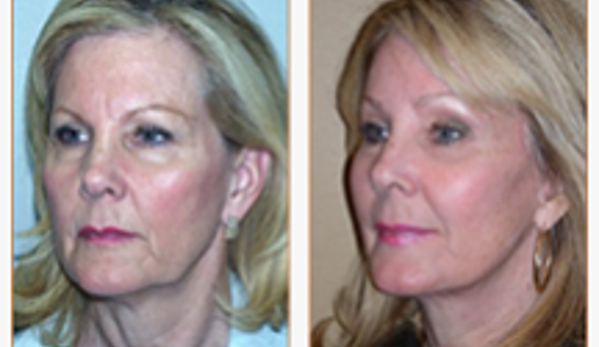 Kessler Plastic Surgery - Corona Del Mar, CA