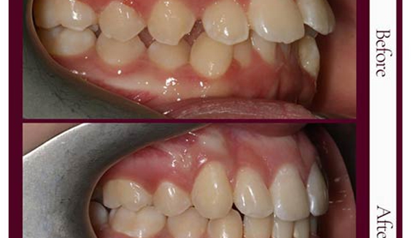 Capital Smiles Orthodontist - Deakin, ACT