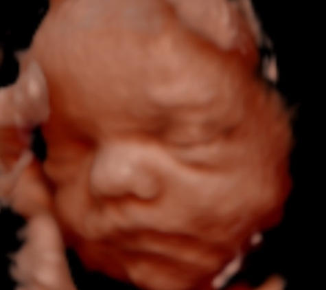 Hello Baby! 4D Ultrasound Studio - Fayetteville, AR