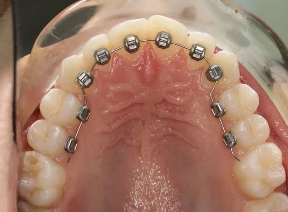 E Orthodontics - Doncaster East, VIC