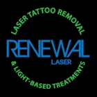 Renewal Laser Tattoo Removal