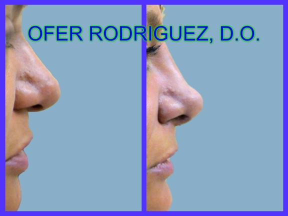 Ofer Rodriguez, D.O. - Miami, FL