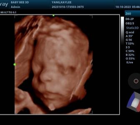 Baby Bee 3D Ultrasound (Fort Worth) - North Richland Hills, TX