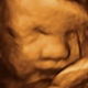 TLC Imaging 3D/4D Ultrasounds