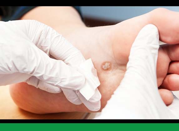 The Foot & Ankle Clinic. - Yarram, VIC. Wart Treatments