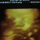 Prenatal Peek, Inc.