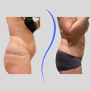 Blue Wolf Transformations - Physicians & Surgeons, Plastic & Reconstructive