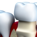 Portland Periodontics-David A. Goldwyn, DDS, PC - Periodontists