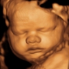 Mother Nurture 3D/4D Ultrasound gallery