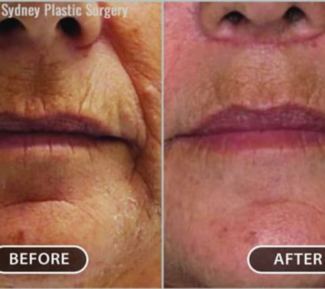 Sydney Plastic Surgery® - Dr Barnouti - Glebe, NSW