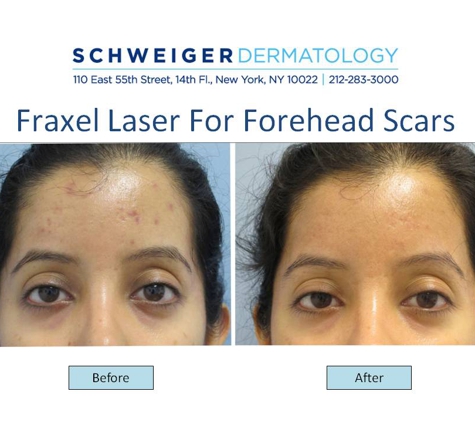 Schweiger Dermatology - Financial District - New york, NY