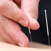 Elite Acupuncture gallery