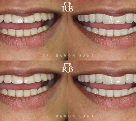 Ramon Bana DDS - Coral Gables, FL