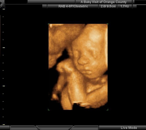 A Baby Visit 4D Ultrasound - Orange, CA