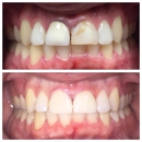 All Smiles Dentistry - Implant Dentistry