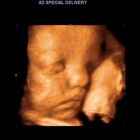 3D 4D Ultrasound by 4D Special Delivery