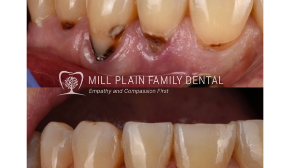 Mill Plain Family Dental - Danbury, CT