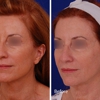 Visage Facial Plastic Surgery gallery