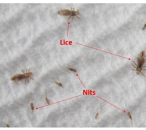 Lice Clinics Of America - Salem - Salem, OR