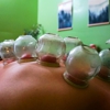 Pinnacle Acupuncture gallery