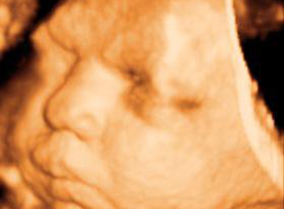 Clear Image 4D Ultrasound : Brooklyn - Brooklyn, NY