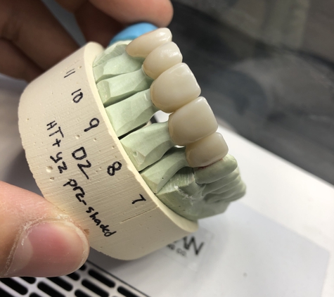 Precision Dental Ceramics Laboratory - Houston, TX