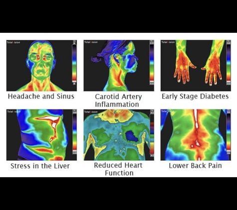 Treasure Coast Thermography - Stuart, FL