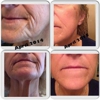 Rodan and Fields Independant Skin Consultant gallery