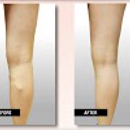 USA Vein Clinics - Physicians & Surgeons, Plastic & Reconstructive