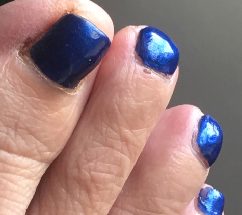 Bella Nails and Spa - Sedalia, MO. Right foot: other side toe from other pic. Scabs appear from abrasions caused by drummel type instrument. Terrible polish job.
