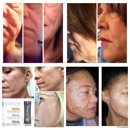 N C Nerium - Skin Care