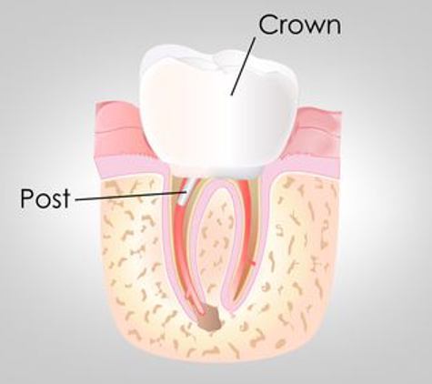 Quality  Dental Care - Hopewell Junction, NY. Quality Dental Care, P.C. | Hopewell Junction, NY