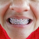 Lovett Dental - Dental Hygienists