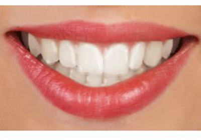 33++ Dental implants concord nc info