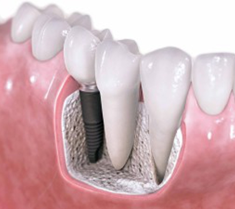 Advance Dental Services - Miranda, NSW