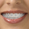 iCare Dental gallery