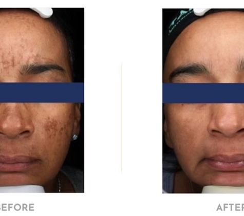 Clean Laser Clinics - Teneriffe, QLD