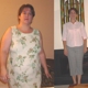 Gastric Sleeve Mexico