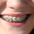 Laurent Caroline A DMD MS - Orthodontists