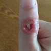 Samantha D'Alessandro, PA-C| Charlotte Dermatology (7th Street) gallery