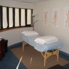 Five Points Acupuncture