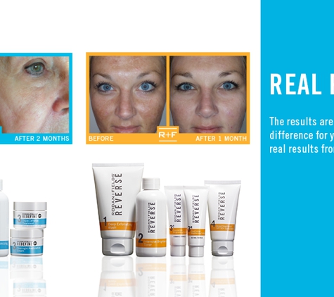 Rodan and Fields Consultant-Betsy Elwood